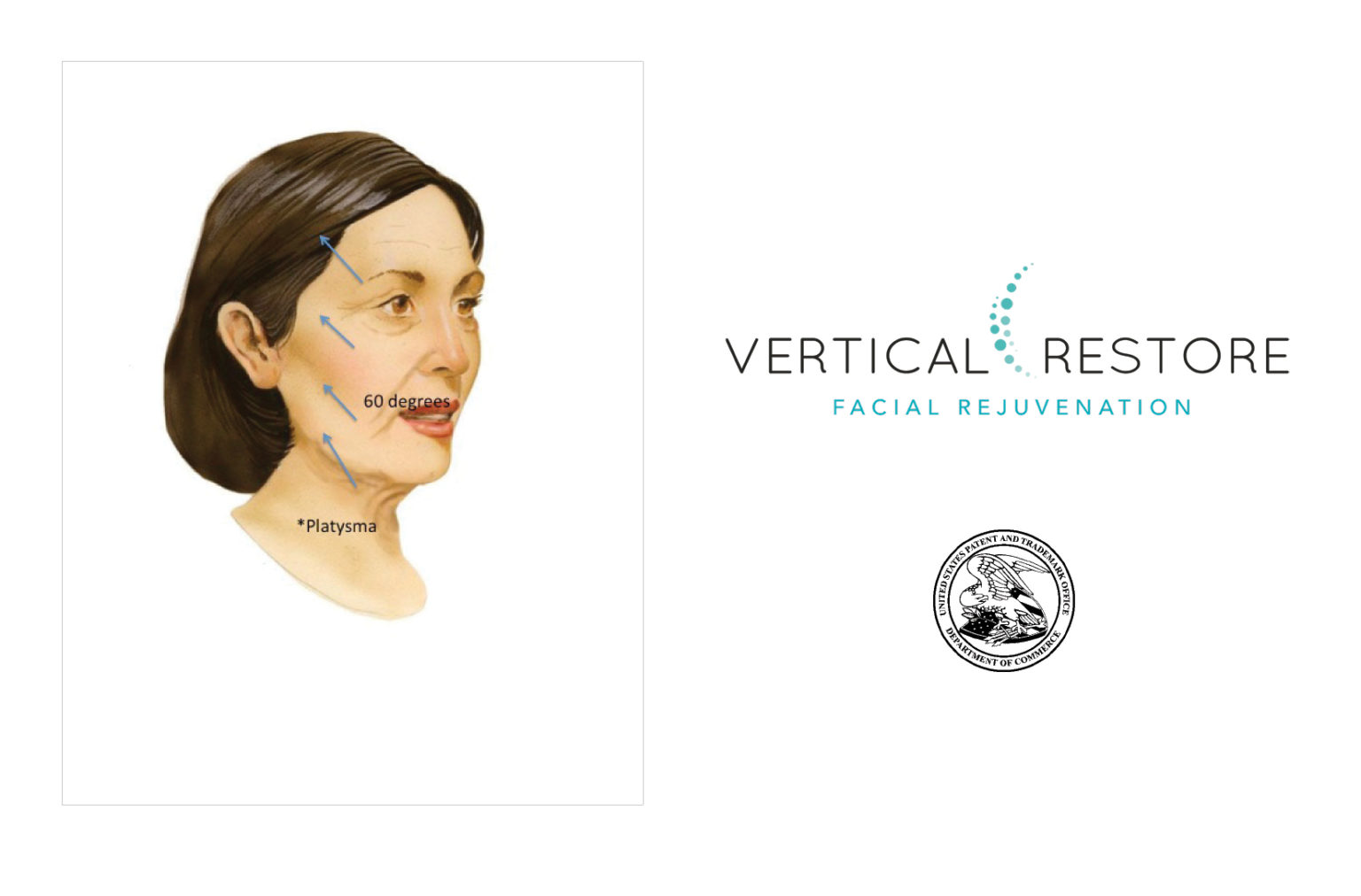 Is Vertical Restore 2021’s Most Promising Procedure? Alphabeautics